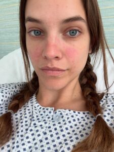 Barbara Palvin otkrila da je imala operaciju koja joj je promenila život