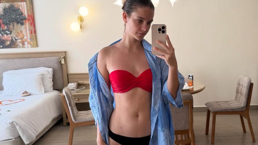 Barbara Palvin otkrila da je imala operaciju koja joj je promenila život