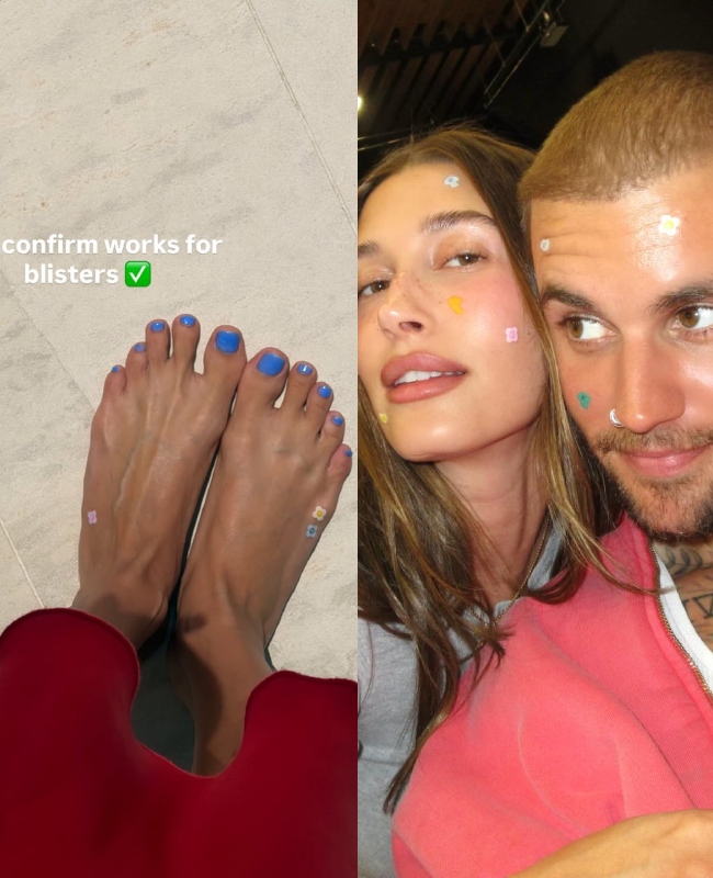 Zašto Hailey Bieber stavlja flastere za bubuljice na stopala?